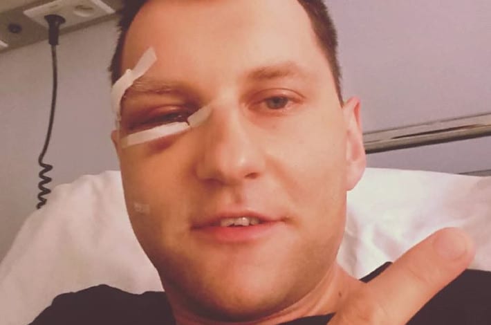 Zelo pobity? Raper przeszedł operację