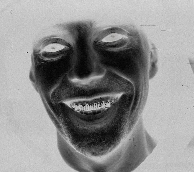 Słoń: „Super się czuje ze świadomością, że jeśli ktokolwiek z moich bliskich zachoruje, to zgnije w kolejce w poczekalni bądź w domu”