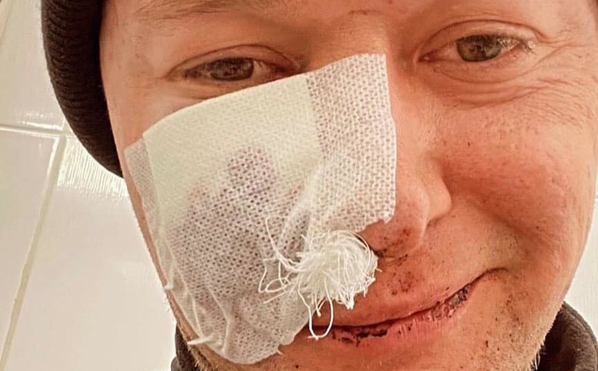 Członek popularnej ukraińskiej grupy ranny podczas walk pod Kijowem