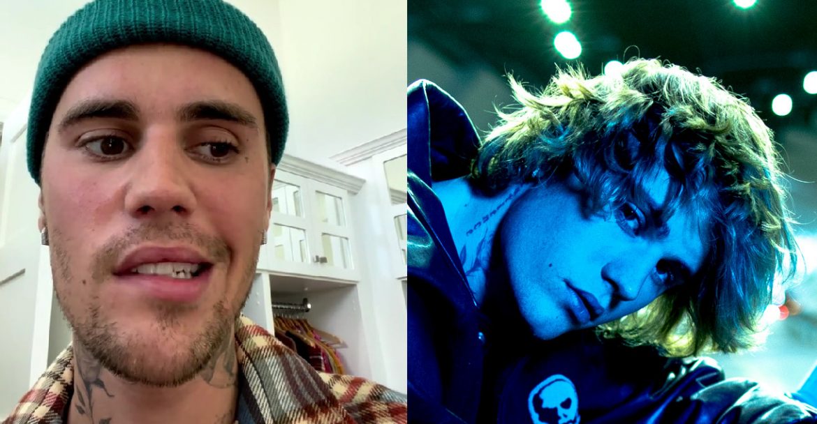 Justin Bieber pokazał sparaliżowaną twarz. Wokalista ma problemy zdrowotne