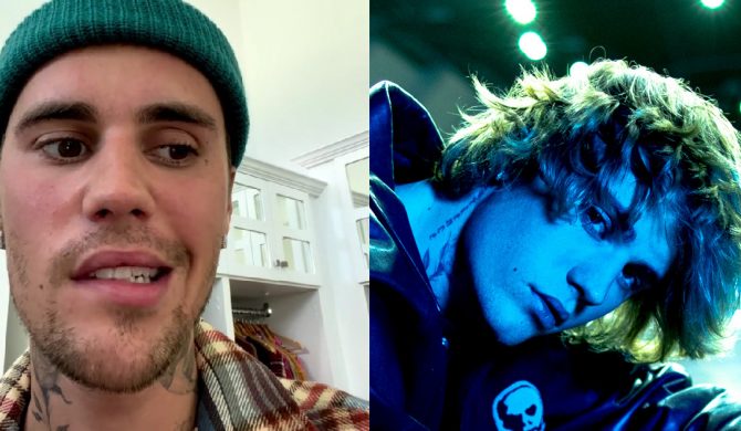 Justin Bieber pokazał sparaliżowaną twarz. Wokalista ma problemy zdrowotne