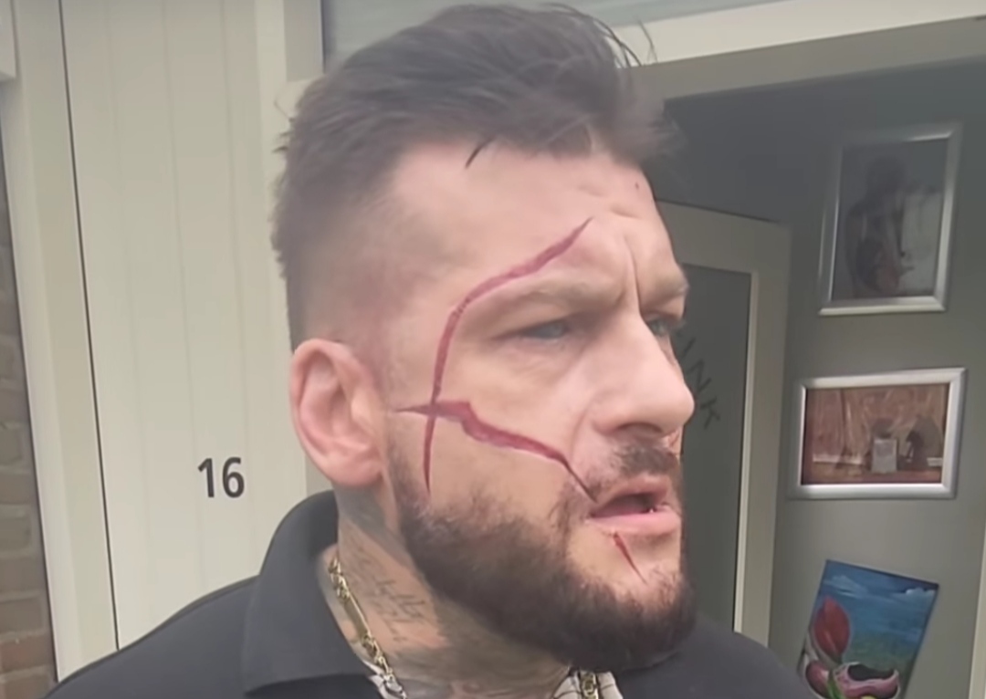 Wygląda na to, że Popek ponownie dokonał skaryfikacji twarzy