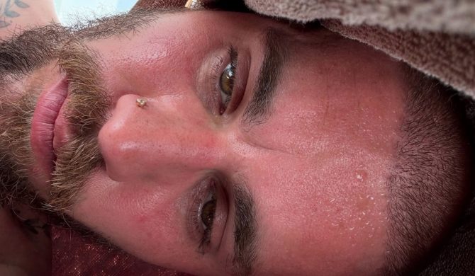 Justin Bieber przechodzi detoks – co się dzieje z gwiazdą pop?