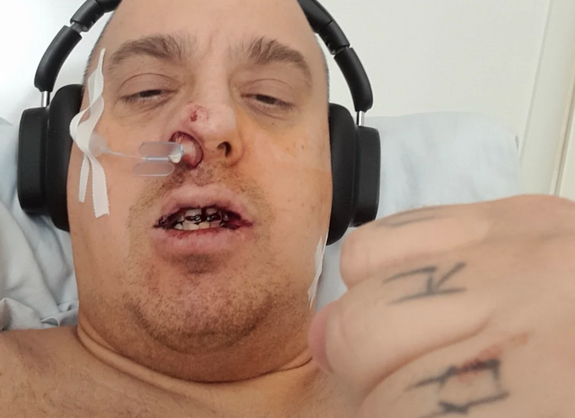 Żurom wyciągnięty spod narkozy – trafił prosto do więzienia. „Przechodziłem piekło w zakładzie karnym. Trzy razy prawie umarłem”