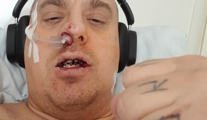 Żurom wyciągnięty spod narkozy – trafił prosto do więzienia. „Przechodziłem piekło w zakładzie karnym. Trzy razy prawie umarłem”