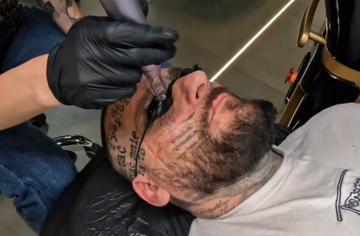 Popek usuwa tatuaże z twarzy – bolesna metamorfoza rapera