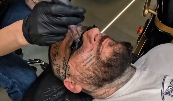 Popek usuwa tatuaże z twarzy – bolesna metamorfoza rapera