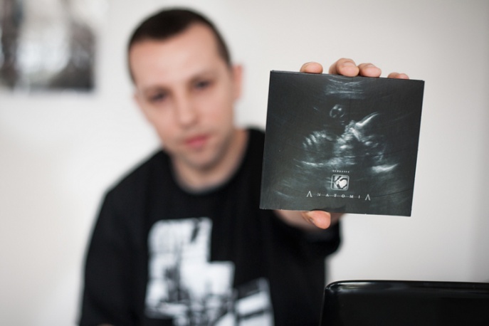 Napisz recenzję „Anatomii” i wygraj płytę K2